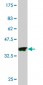 PAK3 Antibody (monoclonal) (M08)